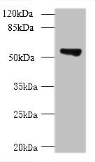 TCP11L2 Antibody - Western blot All lanes: TCP11L2 antibody at 1µg/ml + A549 whole cell lysate Secondary Goat polyclonal to rabbit IgG at 1/10000 dilution Predicted band size: 59, 30 kDa Observed band size: 59 kDa