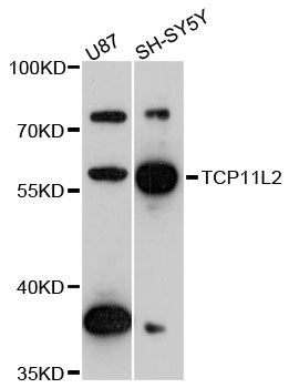 TCP11L2 Antibody - Western blot analysis of extracts of various cell lines, using TCP11L2 antibody at 1:3000 dilution. The secondary antibody used was an HRP Goat Anti-Rabbit IgG (H+L) at 1:10000 dilution. Lysates were loaded 25ug per lane and 3% nonfat dry milk in TBST was used for blocking. An ECL Kit was used for detection and the exposure time was 90s.