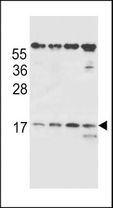 TCR Beta Antibody - TCRB Antibody western blot of MDA-MB231,293,Ramos,NCI-H460 cell line lysates (35 ug/lane). The TCRB antibody detected the TCRB protein (arrow).