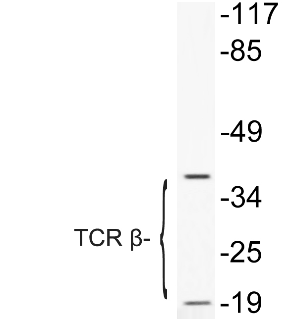 TCR Beta Antibody - Western blot of TCR (K115) pAb in extracts from COLO205 cells treated with Forskolin.