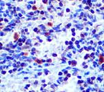 TCR Beta Antibody - IHC of TCR Beta F1 on FFPE Tonsil tissue. This image was taken for the unmodified form of this product. Other forms have not been tested.