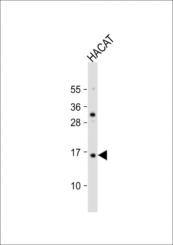 TCTA Antibody - Anti-TCTA Antibody (N-Term) at 1:2000 dilution + HACAT whole cell lysate Lysates/proteins at 20 ug per lane. Secondary Goat Anti-Rabbit IgG, (H+L), Peroxidase conjugated at 1:10000 dilution. Predicted band size: 11 kDa. Blocking/Dilution buffer: 5% NFDM/TBST.