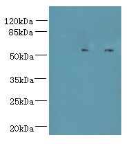 TCTE1 Antibody - Western blot. All lanes: TCTE1 antibody at 3 ug/ml. Lane 1: U251 whole cell lysate. Lane 2: U251 whole cell lysate. Secondary Goat polyclonal to Rabbit IgG at 1:10000 dilution. Predicted band size: 56 kDa. Observed band size: 56 kDa.