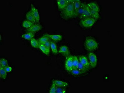 TCTE1 Antibody - Immunofluorescent analysis of HepG2 cells using TCTE1 Antibody at dilution of 1:100 and Alexa Fluor 488-congugated AffiniPure Goat Anti-Rabbit IgG(H+L)