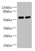 TCTE1 Antibody - Western blot All lanes: TCTE1 antibody at 3µg/ml Lane 1: U251 whole cell lysate Lane 2: U251 whole cell lysate Secondary Goat polyclonal to rabbit IgG at 1/10000 dilution Predicted band size: 56 kDa Observed band size: 56 kDa