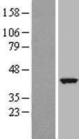 TCTE3 Protein - Western validation with an anti-DDK antibody * L: Control HEK293 lysate R: Over-expression lysate