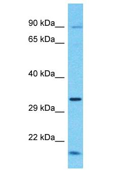 TCTEX1D1 Antibody - TCTEX1D1 antibody Western Blot of HCT15. Antibody dilution: 1 ug/ml.  This image was taken for the unconjugated form of this product. Other forms have not been tested.