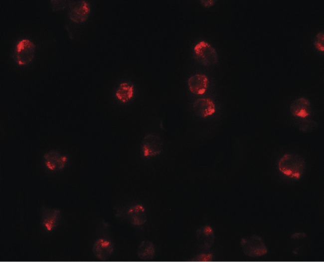 TCTEX1D2 Antibody - Immunofluorescence of TCTEX1D2 in K562 cells with TCTEX1D2 antibody at 20 ug/ml.