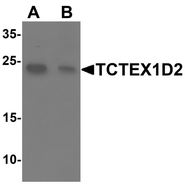 TCTEX1D2 Antibody - Western blot analysis of TCTEX1D2 in K562 cell lysate with TCTEX1D2 antibody at 1 ug/ml in (A) the absence and (B) the presence of blocking peptide.