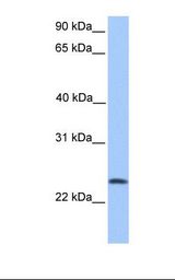 TCTEX1D4 Antibody - 721_B cell lysate. Antibody concentration: 1.0 ug/ml. Gel concentration: 12%.  This image was taken for the unconjugated form of this product. Other forms have not been tested.