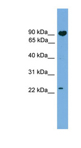 TCTEX1D4 Antibody - TCTEX1D4 antibody Western blot of 721_B cell lysate. This image was taken for the unconjugated form of this product. Other forms have not been tested.