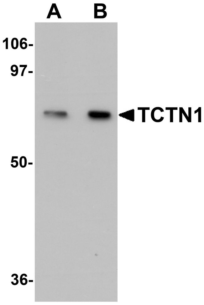 TCTN1 Antibody - Western blot analysis of TCTN1 in mouse kidney tissue lysate with TCTN1 antibody at (A) 1 and (B) 2ug/ml.