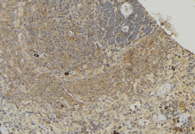 TCTN1 Antibody - 1:100 staining human lymph node tissue by IHC-P. The sample was formaldehyde fixed and a heat mediated antigen retrieval step in citrate buffer was performed. The sample was then blocked and incubated with the antibody for 1.5 hours at 22°C. An HRP conjugated goat anti-rabbit antibody was used as the secondary.