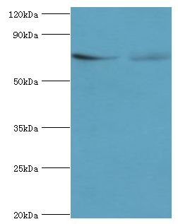 TCTN2 Antibody - Western blot. All lanes: Tectonic-2 antibody at 10 ug/ml. Lane 1: Jurkat whole cell lysate. Lane 2: A549 whole cell lysate. Secondary antibody: Goat polyclonal to rabbit at 1:10000 dilution. Predicted band size: 77 kDa. Observed band size: 77 kDa Immunohistochemistry I.