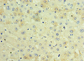 TCTN2 Antibody - Immunohistochemistry of paraffin-embedded human liver tissue using TCTN2 Antibody at dilution of 1:100