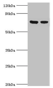 TCTN2 Antibody - Western blot All lanes: TCTN2 antibody at 10µg/ml Lane 1: Jurkat whole cell lysate Lane 2: A549 whole cell lysate Secondary Goat polyclonal to rabbit IgG at 1/10000 dilution Predicted band size: 77 kDa Observed band size: 77 kDa