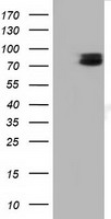 TCTN2 Antibody - HEK293T cells were transfected with the pCMV6-ENTRY control (Left lane) or pCMV6-ENTRY TCTN2 (Right lane) cDNA for 48 hrs and lysed. Equivalent amounts of cell lysates (5 ug per lane) were separated by SDS-PAGE and immunoblotted with anti-TCTN2.