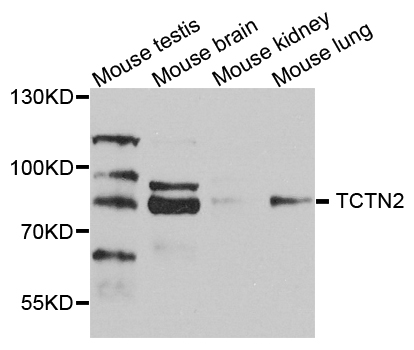 TCTN2 Antibody - Western blot analysis of extract of various cells.