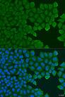 TCTN2 Antibody - Immunofluorescence analysis of U2OS cells using TCTN2 Polyclonal Antibody at dilution of 1:100.Blue: DAPI for nuclear staining.