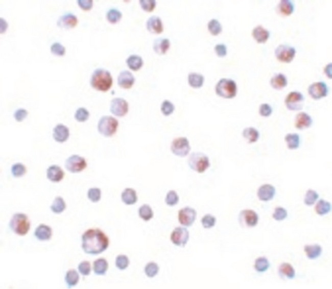 TCTN3 Antibody - Immunocytochemistry of TCTN3 in HeLa cells with TCTN3 antibody at 4 ug/ml.
