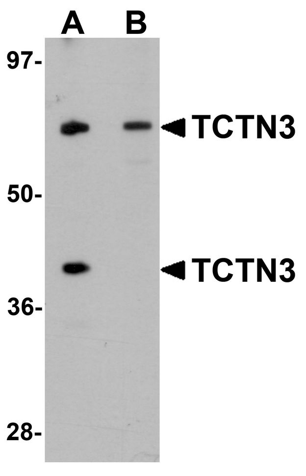 TCTN3 Antibody - Western blot analysis of TCTN3 in HeLa cell lysate with TCTN3 antibody at (A) 1 and (B) 2ug/ml.