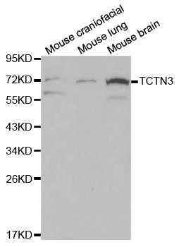 TCTN3 Antibody - Western blot analysis of extracts of various cell lines, using TCTN3 antibody at 1:500 dilution. The secondary antibody used was an HRP Goat Anti-Rabbit IgG (H+L) at 1:10000 dilution. Lysates were loaded 25ug per lane and 3% nonfat dry milk in TBST was used for blocking.