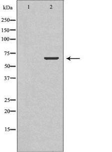 TCTN3 Antibody - Western blot analysis of mouse brain lysate using TCTN3 antibody. The lane on the left is treated with the antigen-specific peptide.