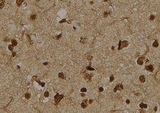 TCTN3 Antibody - 1:100 staining human brain tissue by IHC-P. The sample was formaldehyde fixed and a heat mediated antigen retrieval step in citrate buffer was performed. The sample was then blocked and incubated with the antibody for 1.5 hours at 22°C. An HRP conjugated goat anti-rabbit antibody was used as the secondary.