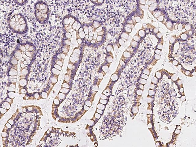 TCTN3 Antibody - Immunochemical staining of human TCTN3 in human small intestine with rabbit polyclonal antibody at 1:300 dilution, formalin-fixed paraffin embedded sections.