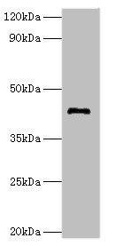 TDG / Thymine DNA Glycosylase Antibody - Western blot All lanes: G/T mismatch-specific thymine DNA glycosylase antibody at 8µg/ml + Mouse brain tissue Secondary Goat polyclonal to rabbit IgG at 1/10000 dilution Predicted band size: 46 kDa Observed band size: 46 kDa