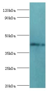 TDG / Thymine DNA Glycosylase Antibody - Western blot. All lanes: G/T mismatch-specific thymine DNA glycosylase antibody at 6 ug/ml+mouse brain tissue. Secondary antibody: Goat polyclonal to rabbit at 1:10000 dilution. Predicted band size: 46 kDa. Observed band size: 46 kDa Immunohistochemistry.