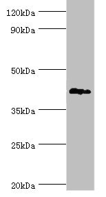 TDG / Thymine DNA Glycosylase Antibody - Western blot All lanes: G/T mismatch-specific thymine DNA glycosylase antibody at 6µg/ml + Mouse brain tissue Secondary Goat polyclonal to rabbit IgG at 1/10000 dilution Predicted band size: 46 kDa Observed band size: 46 kDa