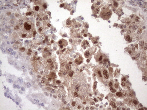 TDG / Thymine DNA Glycosylase Antibody - Immunohistochemical staining of paraffin-embedded Human Kidney tissue within the normal limits using anti-TDG mouse monoclonal antibody. (Heat-induced epitope retrieval by 1mM EDTA in 10mM Tris buffer. (pH8.5) at 120 oC for 3 min. (1:150)