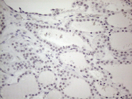 TDG / Thymine DNA Glycosylase Antibody - Immunohistochemical staining of paraffin-embedded Human thyroid tissue within the normal limits using anti-TDG mouse monoclonal antibody. (Heat-induced epitope retrieval by 1mM EDTA in 10mM Tris buffer. (pH8.5) at 120°C for 3 min. (1:150)