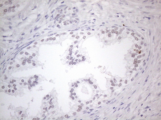 TDG / Thymine DNA Glycosylase Antibody - Immunohistochemical staining of paraffin-embedded Human prostate tissue within the normal limits using anti-TDG mouse monoclonal antibody. (Heat-induced epitope retrieval by 1mM EDTA in 10mM Tris buffer. (pH8.5) at 120°C for 3 min. (1:150)