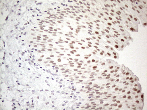 TDG / Thymine DNA Glycosylase Antibody - Immunohistochemical staining of paraffin-embedded Human bladder tissue within the normal limits using anti-TDG mouse monoclonal antibody. (Heat-induced epitope retrieval by 1mM EDTA in 10mM Tris buffer. (pH8.5) at 120°C for 3 min. (1:150)