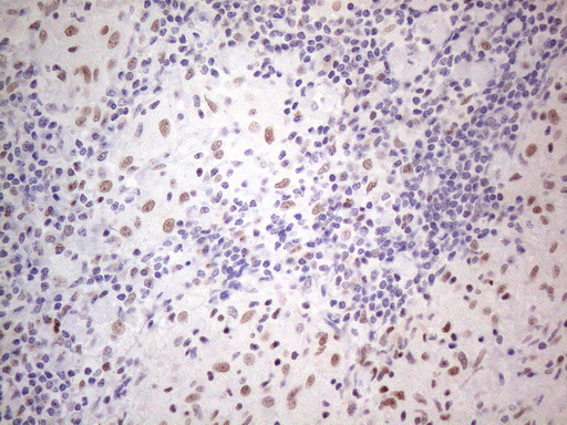 TDG / Thymine DNA Glycosylase Antibody - Immunohistochemical staining of paraffin-embedded Human lymph node tissue within the normal limits using anti-TDG mouse monoclonal antibody. (Heat-induced epitope retrieval by 1mM EDTA in 10mM Tris buffer. (pH8.5) at 120°C for 3 min. (1:150)