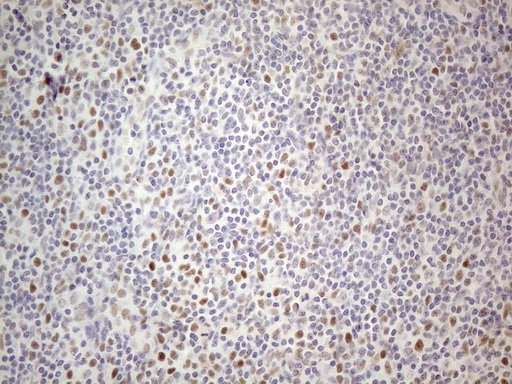 TDG / Thymine DNA Glycosylase Antibody - Immunohistochemical staining of paraffin-embedded Human tonsil within the normal limits using anti-TDG mouse monoclonal antibody. (Heat-induced epitope retrieval by 1mM EDTA in 10mM Tris buffer. (pH8.5) at 120°C for 3 min. (1:150)