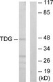TDG / Thymine DNA Glycosylase Antibody - Western blot analysis of lysates from Jurkat cells, using TDG Antibody. The lane on the right is blocked with the synthesized peptide.