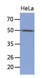 TDG / Thymine DNA Glycosylase Antibody - Western Blot: The cell lysates of HeLa (30 ug) were resolved by SDS-PAGE, transferred to PVDF membrane and probed with anti-human TDG antibody (1:250). Proteins were visualized using a goat anti-mouse secondary antibody conjugated to HRP and an ECL detection system.