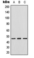 TDG / Thymine DNA Glycosylase Antibody - Western blot analysis of Thymine DNA Glycosylase expression in HeLa (A); mouse lung (B); rat lung (C) whole cell lysates.