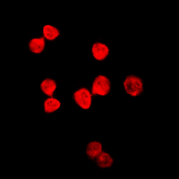 TDG / Thymine DNA Glycosylase Antibody - Immunofluorescent analysis of Thymine DNA Glycosylase staining in HeLa cells. Formalin-fixed cells were permeabilized with 0.1% Triton X-100 in TBS for 5-10 minutes and blocked with 3% BSA-PBS for 30 minutes at room temperature. Cells were probed with the primary antibody in 3% BSA-PBS and incubated overnight at 4 C in a humidified chamber. Cells were washed with PBST and incubated with a DyLight 594-conjugated secondary antibody (red) in PBS at room temperature in the dark. DAPI was used to stain the cell nuclei (blue).