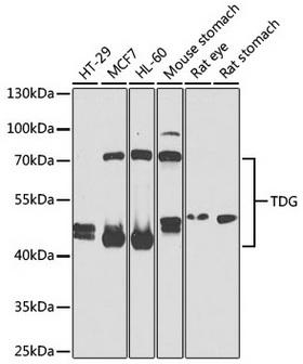 TDG / Thymine DNA Glycosylase Antibody - Western blot analysis of extracts of various cell lines, using TDG antibody at 1:1000 dilution. Secondary antibody: HRP Goat Anti-Rabbit IgG (H+L) at 1:10000 dilution. Lysates/proteins: 25ug per lane. Blocking buffer: 3% nonfat dry milk in TBST. Detection: ECL Basic Kit. Exposure time: 5s.