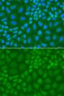 TDG / Thymine DNA Glycosylase Antibody - Immunofluorescence analysis of A549 cells using TDG antibody. Blue: DAPI for nuclear staining.
