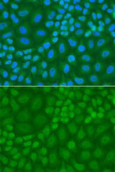 TDG / Thymine DNA Glycosylase Antibody - Immunofluorescence analysis of A549 cells using TDG antibody. Blue: DAPI for nuclear staining.