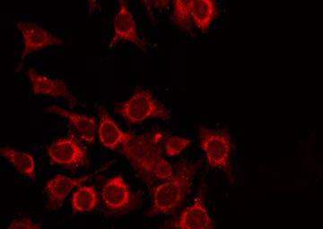 TDG / Thymine DNA Glycosylase Antibody - Staining HeLa cells by IF/ICC. The samples were fixed with PFA and permeabilized in 0.1% Triton X-100, then blocked in 10% serum for 45 min at 25°C. The primary antibody was diluted at 1:200 and incubated with the sample for 1 hour at 37°C. An Alexa Fluor 594 conjugated goat anti-rabbit IgG (H+L) Ab, diluted at 1/600, was used as the secondary antibody.