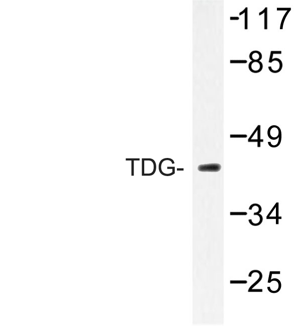 TDG / Thymine DNA Glycosylase Antibody - Western blot of TDG (K90) pAb in extracts from Jurkat cells.