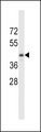 TDO2 Antibody - TDO2 Antibody western blot of MDA-MB453 cell line lysates (35 ug/lane). The TDO2 antibody detected the TDO2 protein (arrow).