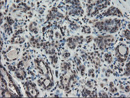 TDO2 Antibody - IHC of paraffin-embedded Human breast tissue using anti-TDO2 mouse monoclonal antibody.