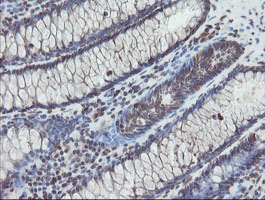 TDO2 Antibody - IHC of paraffin-embedded Human colon tissue using anti-TDO2 mouse monoclonal antibody.